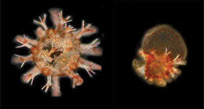 A 5-day-old sea urchin reared in today's ocean conditions compared to one reared in high temperature and low pH A 5-day-old sea urchin reared in today's ocean conditions compared to one reared in high temperature and low pH